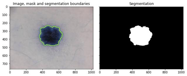 ../_images/tutorials_scene_segmentation_rf_isic_tutorial_13_0.png